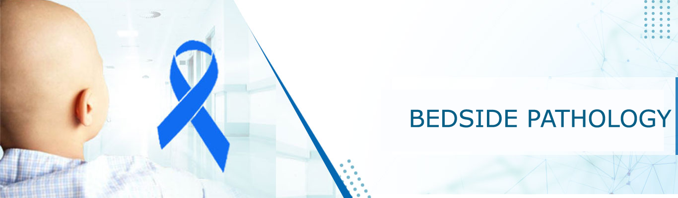 Paediatric Hemato Oncology